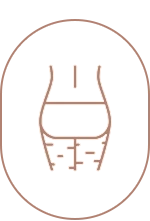 Reducere celulită focsani vrancea